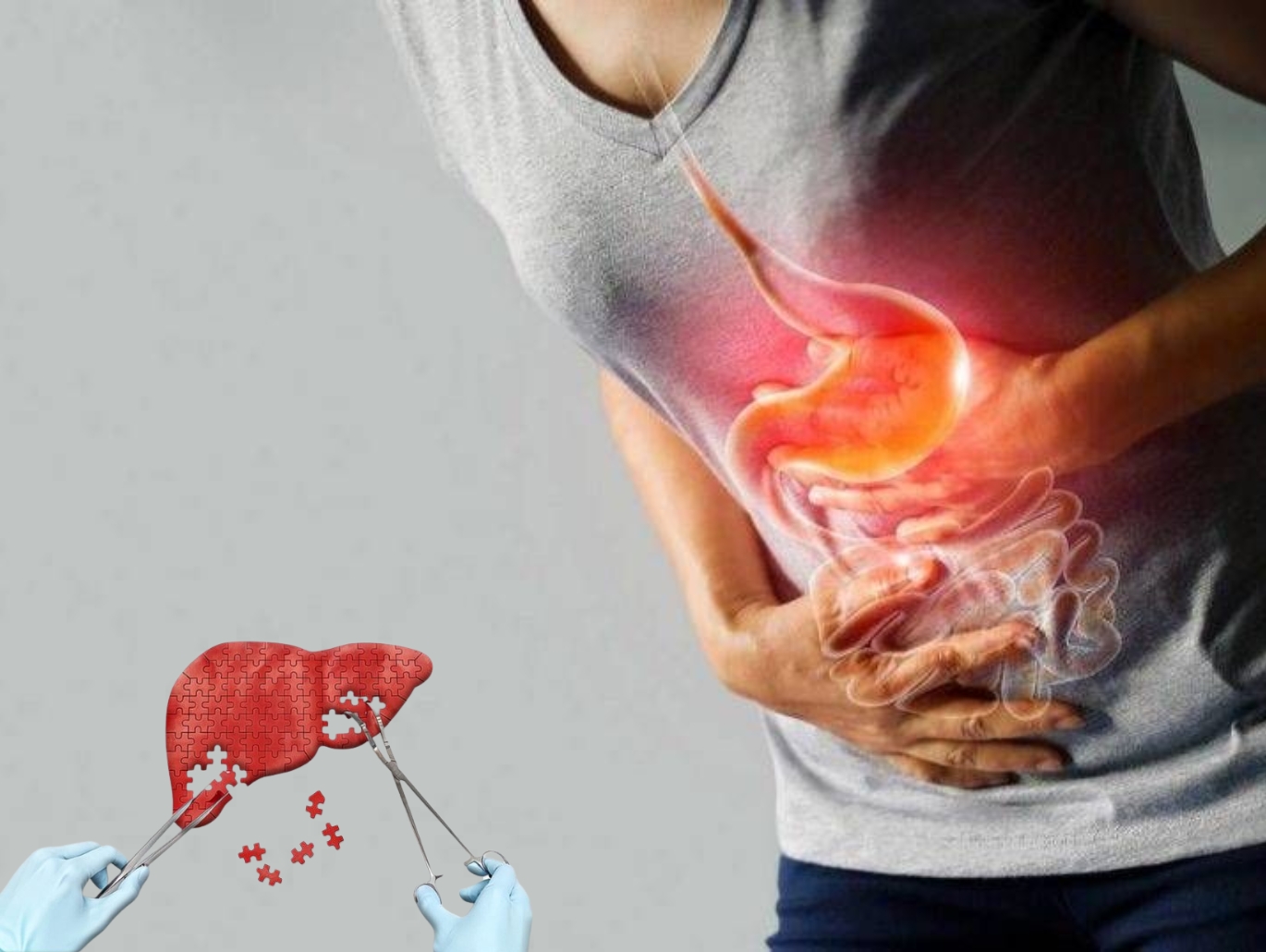 Gastrointestinal Surgery