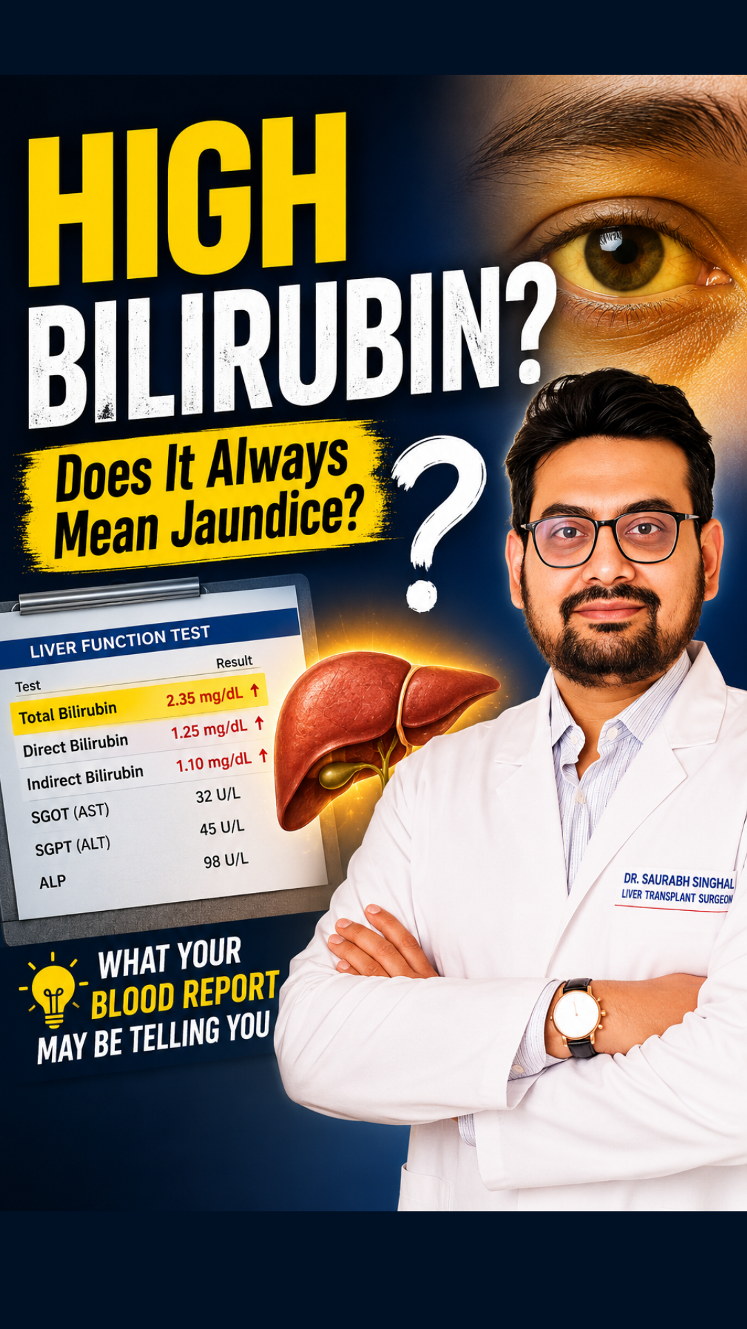 Alcohol-Related Liver Disease